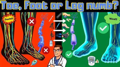 Do you have toe numbness or foot numbness? [ Causes & Treatment]