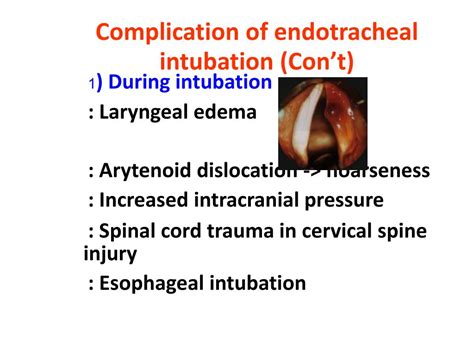 Complications Of Endotracheal Intubation Endotracheal Intubation ...