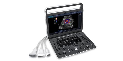 Sonoscape E3 Colour Doppler Ultrasound Machine - Portable Ultrasound ...