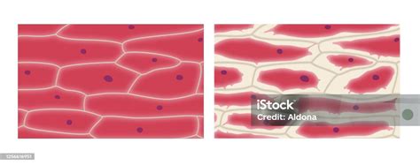 Plasmolysis In Onion Epidermis Cells Stock Illustration - Download Image Now - Onion, Biological ...