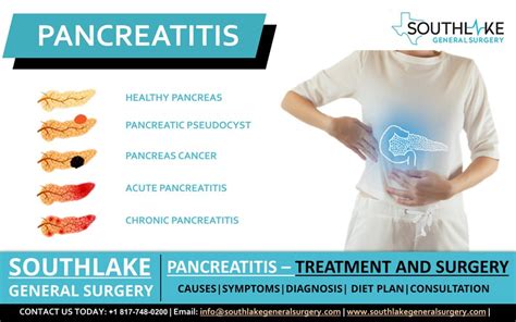 Pancreatitis Treatment and Surgery - Southlake General Surgery