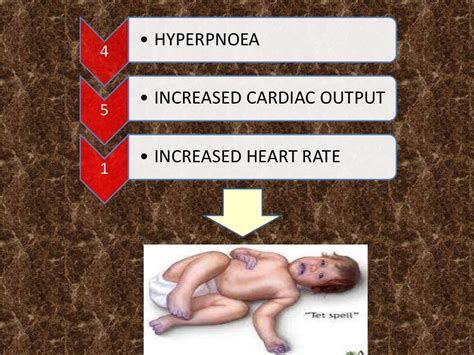 TETRALOGY OF FALLOT AND TET SPELL presentation