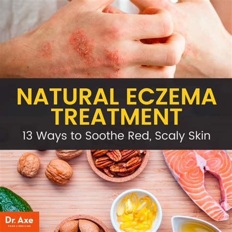 Dyshidrotic eczema cure information | Variuos