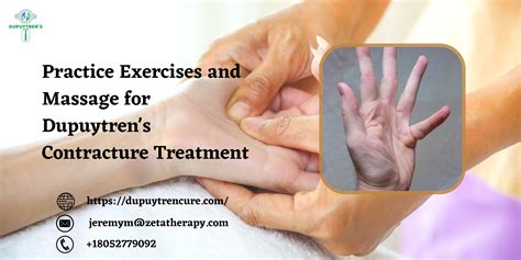 Practice Exercises and Massage for Dupuytren's Contracture Treatment by dupuytrenswand - Issuu