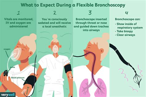 Bronchoscopy: Uses, Side Effects, Procedure, Results