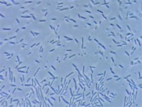 E Coli Bacteria Under Light Microscope - Micropedia