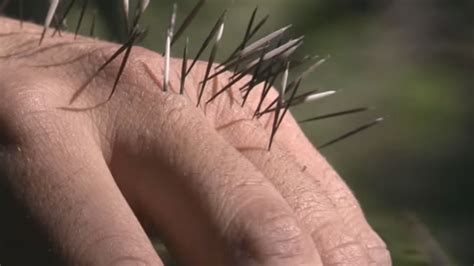 What Happens When You Get Quilled by a Porcupine | Mental Floss