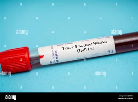 Thyroid stimulating hormone test Stock Photo - Alamy