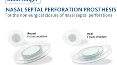 Understanding Nasal Septum Perforation Symptoms: A Comprehensive Guide - Skills Dentist