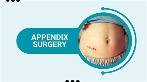 Appendix Surgery