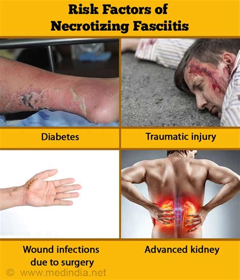 Necrotizing Fasciitis (NF) | Flesh-Eating Disease - Causes, Risk Factors, Symptoms, Diagnosis ...