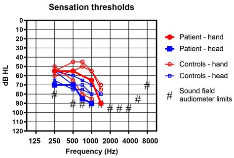 Using a Bone Conduction Hearing Device as a Tactile Aid