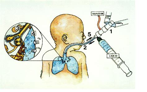 Liquid breathing ~ Detailed Information | Photos | Videos