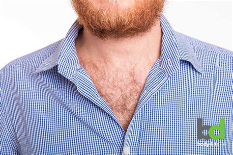 Laser Chest Hair Removal – 10 Things Men Need to Know