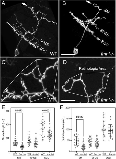 fmr1 mutants exhibit defects in PyrN dendrite development. (A,B)... | Download Scientific Diagram