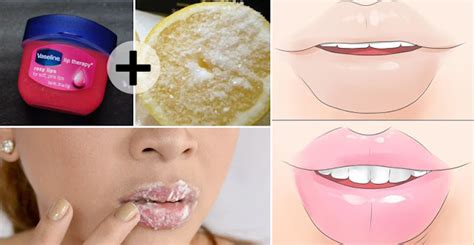 Want Pink And Smooth Lips? Try These 10 Home Remedies And Achieve Pink Lips In No Time! - Style ...