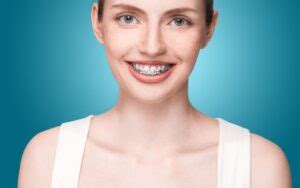 Braces and Wisdom Teeth - Charleston Orthodontics Powered By Smile Doctors