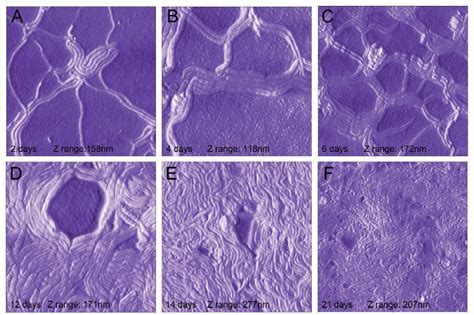 Spirochetes Unwound: Biofilms of the Lyme disease spirochete