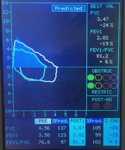 Kinesiology students use various test conditions to estimate lung function – Faculty of Health ...