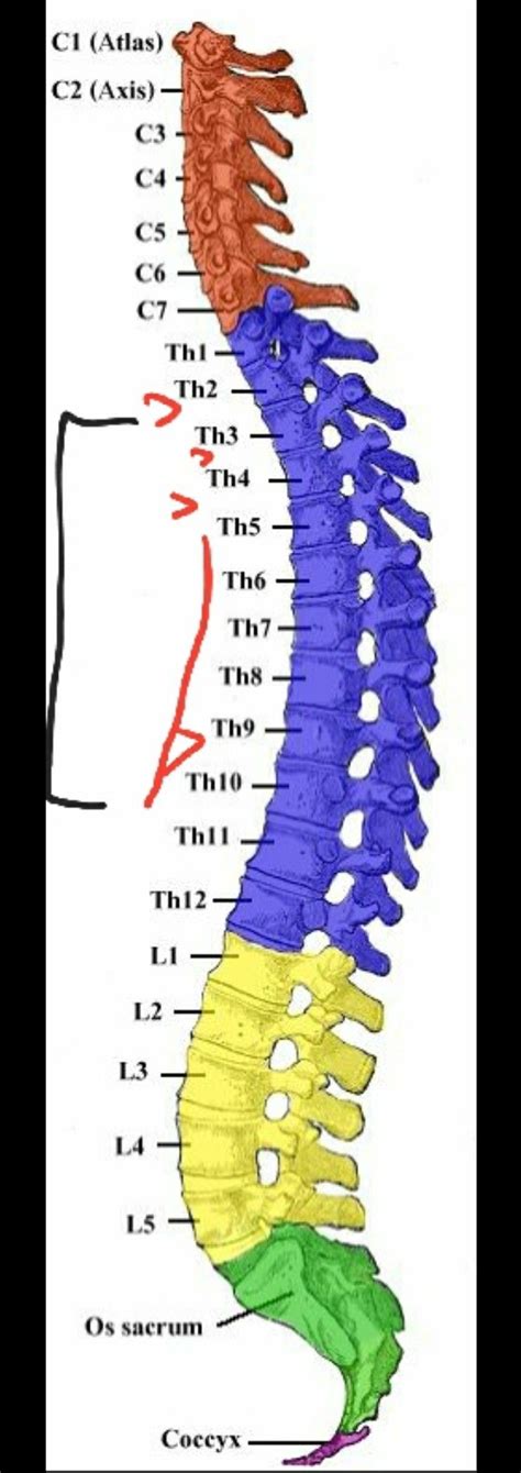 Naturally Fused Vertebrae Treatment - Wedding Ideas You have Never Seen Before