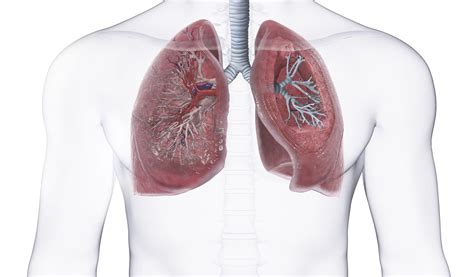 Bronchopleural Fistula Causes and Treatment