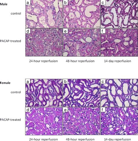 Representative photomicrographs of PAS-H-stained kidney sections of... | Download Scientific Diagram