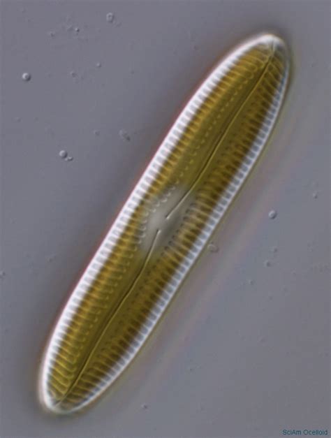 Diatoms are beautiful! | Diatom, Things under a microscope, Microscopic