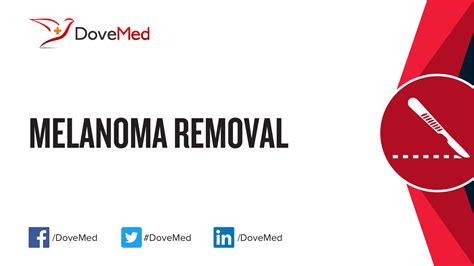 Melanoma Removal