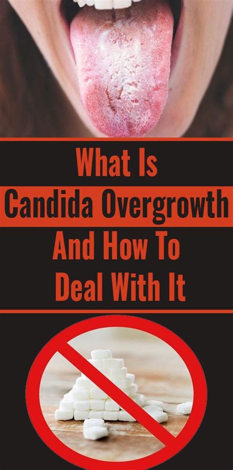 What Is Candida Overgrowth And How To Deal With It | Wellness Click