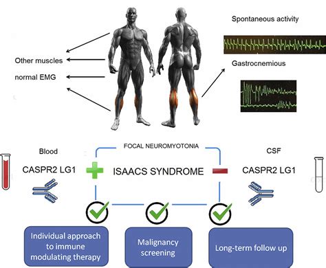 Isaacs syndrome causes, symptoms, diagnosis, treatment & prognosis