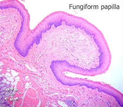 Tongue Histology - Fungiform papillae - histology slide