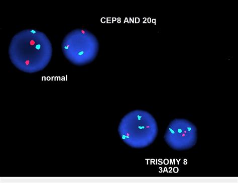 Fluorescence In Situ Hybridization Detection Of Chromosome, 56% OFF