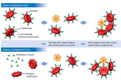 Types of Agglutination Reactions