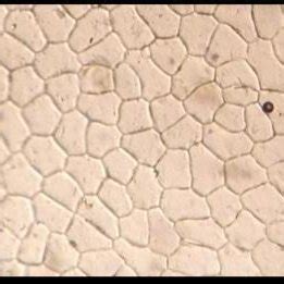 (A and B) The lower epidermis showing anomocytic stomata A-(x 200) and ...