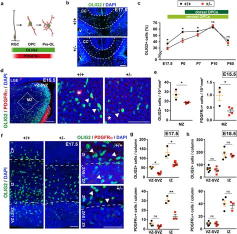 A deficit in ventral oligodendroglia cells during the development of... | Download Scientific ...