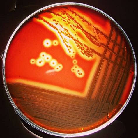 Hemolysis Types - Microbiology Laboratory Turkey