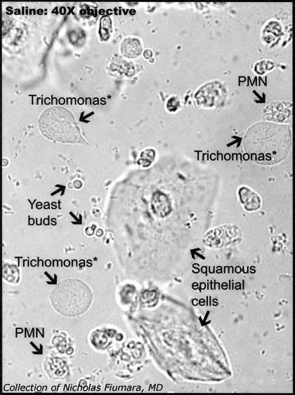 Microscopic examination of urine