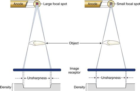 6. Projection Geometry | Pocket Dentistry