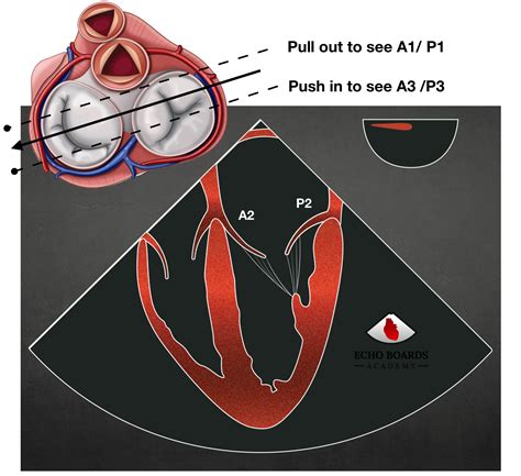 Mitral Valve Anatomy | EchoBoardsAcademy