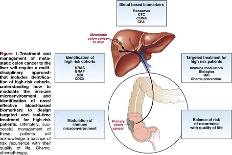 Figure 1 from Colorectal Cancer Liver Metastasis: Evolving Paradigms ...