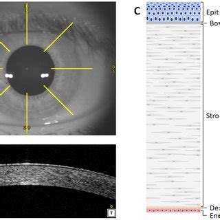 Comparison of advanced in vitro corneal models. | Download Scientific ...