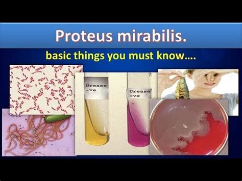 Proteus mirabilis(simply, clear overview)#Proteusmirabilis#Microbiology ...