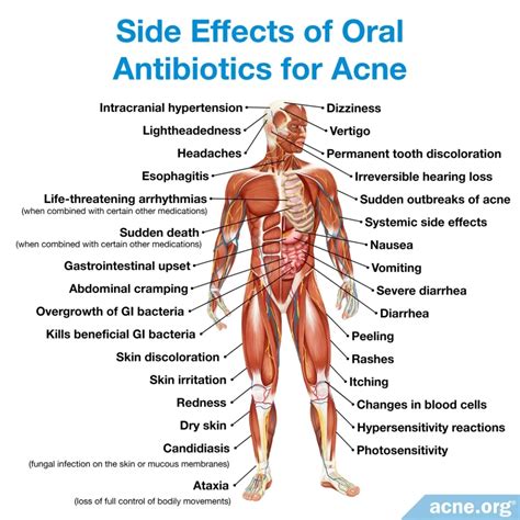 Should You Pop Cystic Acne? - Acne.org