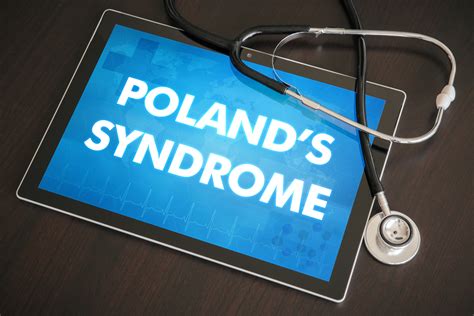 Poland syndrome