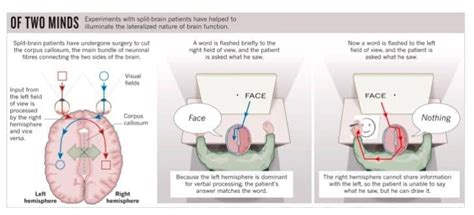 What Are Split Brain Experiments? - Edublox Online Tutor