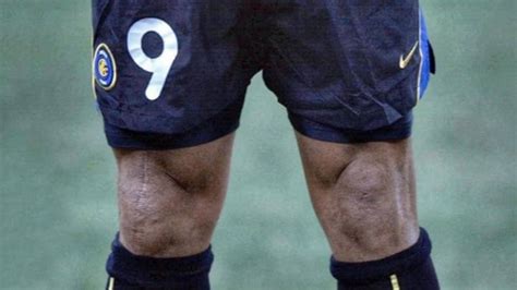 Ronaldo Nazário: The Tragic Knee Injury That Defined His Career ...