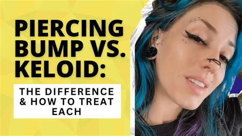 Dealing with a Piercing Bump or Keloid? Here's What You Need to Know – baselaboratories