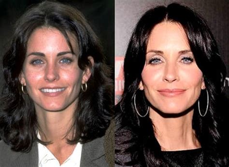 Courteney Cox Plastic Surgery Speculations Have Been Confirmed