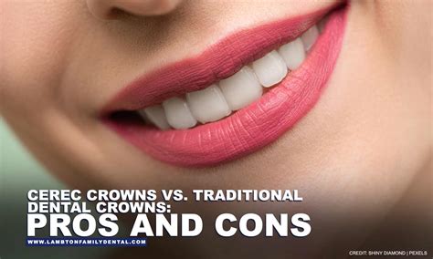 CEREC Crowns vs. Traditional Dental Crowns: Pros and Cons | Lambton Family Dental