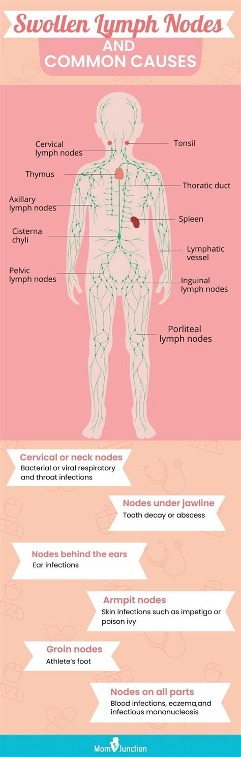 Swollen Lymph Nodes In Children Causes And When To Worry – NBKomputer